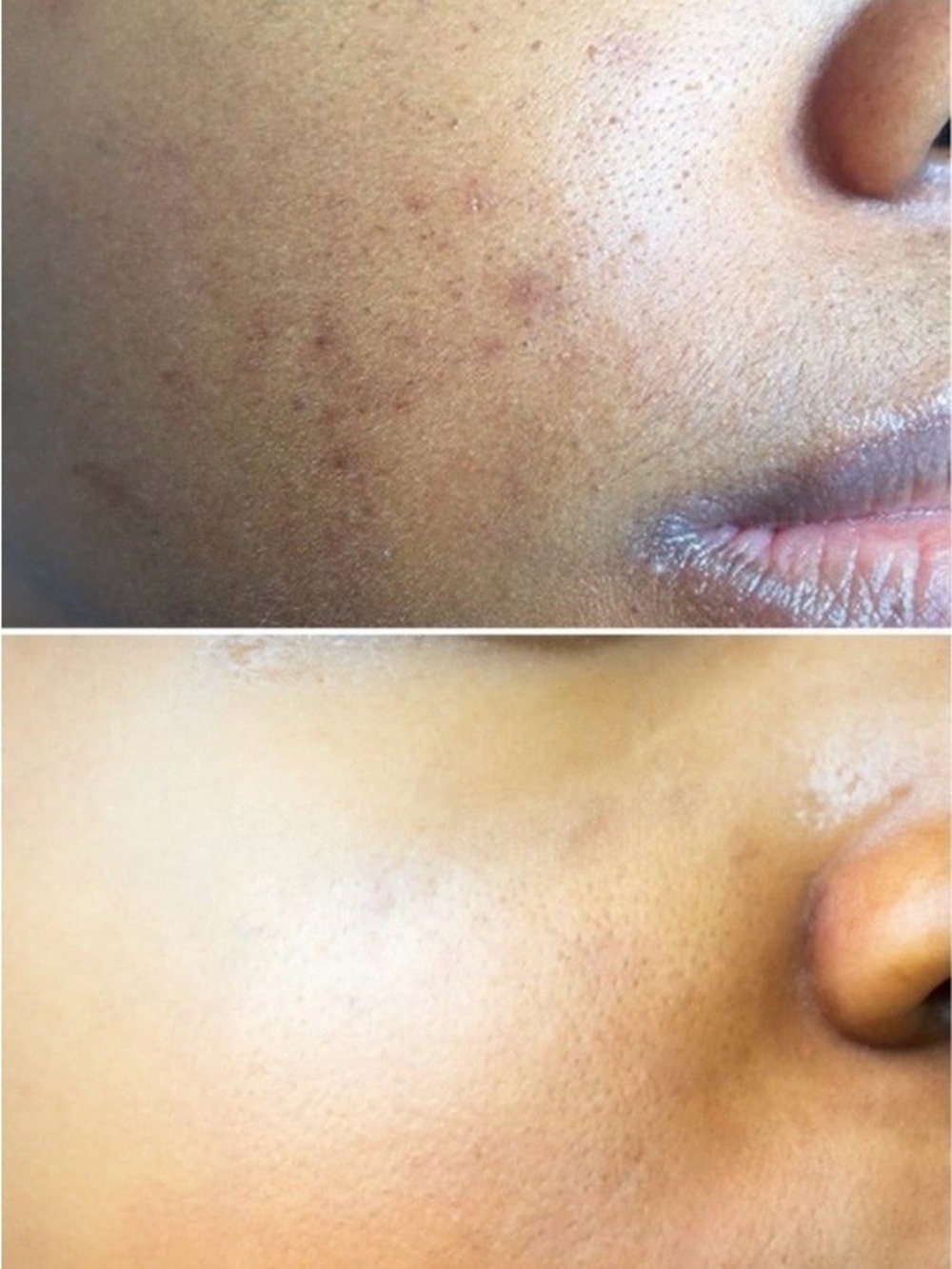 Prédiré Paris Triple Acting Facial Cleansing Scrub - Picture 4 of 5